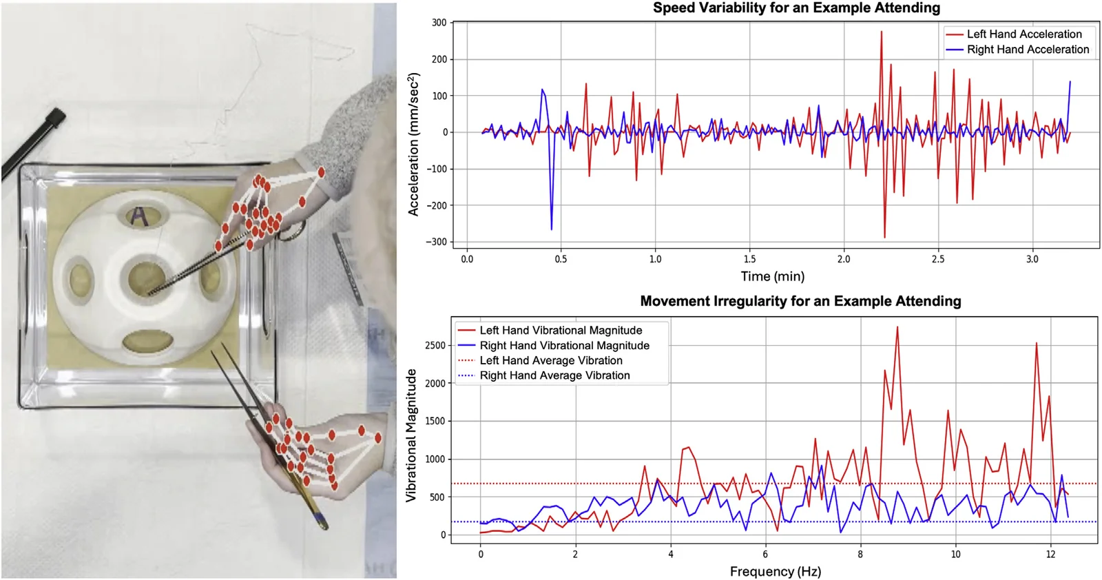Published research figure showing AI hand-motion tracking in surgical suturing